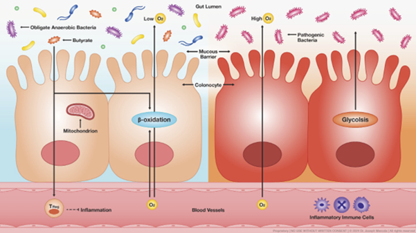 10.1ColonocyteMetabolismDetermines_Gut_Health.png
